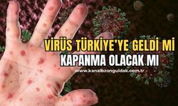 Kısıtlama gelecek mi? Sağlık Bakanlığı'ndan 'M çiçeği (mpox) hastalığı' açıklaması!