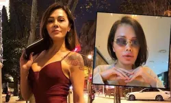 Eski Survivor yarışmacısı Didem Ceran yüz nakliyle tanınmaz hale geldi!