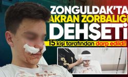 Zonguldak’ta okul çıkışı d*hşet: 15 kişi 14 yaşındaki öğrenciye saldırdı!