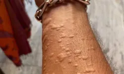 Erkek arkadaşını ziyaret eden kadın yardım istedi