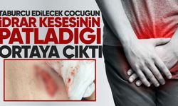 Taburcu edilmek istenen çocuğun idrar kesesinin patladığı ortaya çıktı