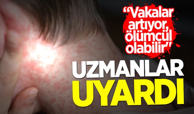 Uzmanlar uyardı: “Vakalar artıyor, ölümcül olabilir"