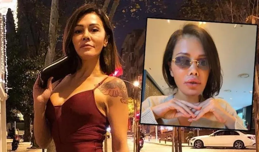 Eski Survivor yarışmacısı Didem Ceran yüz nakliyle tanınmaz hale geldi!