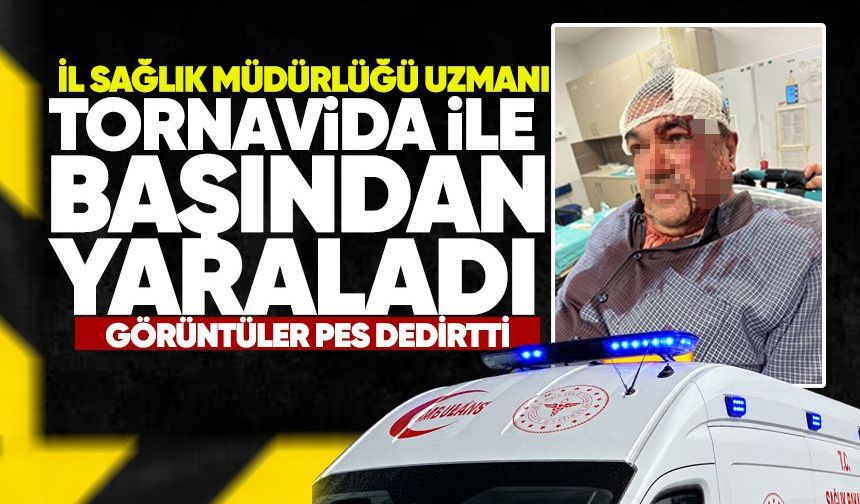 İl Sağlık Müdürlüğü uzmanı, komşusunu tornovida ile başından yaraladı: Görüntüler pes dedirtti!